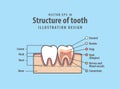 Cross-section structure compare inside and outside tooth diagram and chart illustration vector on blue background. Dental care Royalty Free Stock Photo
