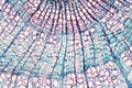 Cross section - Xylem is a type of tissue in vascular plants that transports water and some nutrients