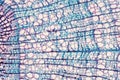 Cross section - Xylem is a type of tissue in vascular plants that transports water and some nutrients