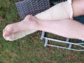 Crossed broken leg of guys resting on table over crutches on grass Royalty Free Stock Photo