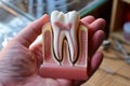 crosssectioned tooth model in hand Royalty Free Stock Photo