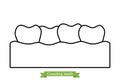 Crowding teeth malocclusion - cartoon vector outline style Royalty Free Stock Photo