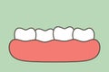 Crowding teeth malocclusion, dental problem Royalty Free Stock Photo