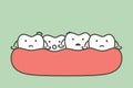 Crowding teeth malocclusion, dental problem Royalty Free Stock Photo