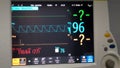 Vital signs, resuscitation unit, ambulatory Surgery