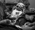 Crying baby who has just been born from a cesarean section in a delivery room in santa Catarina brazil