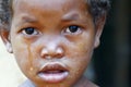 Crying girl with tear on cheek - poor african child Royalty Free Stock Photo