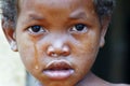 Crying girl with tear on cheek - poor african child Royalty Free Stock Photo