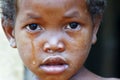 Crying girl with tear on cheek - poor african child