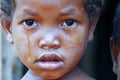 Crying girl with tear on cheek - poor african child Royalty Free Stock Photo