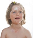 Crying little girl with smallpox