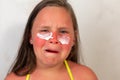 Crying school aged girl suffer from burns on face after spending time in sun. Child applying after-sun cream to inflamed