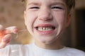 crying 6 years boy who is trying to tear up his milk tooth by thread. Feeling of pain and fear Royalty Free Stock Photo