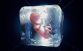 A cryopreserved fetus frozen into ice cube