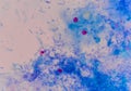 Cryptosporidium oocyte on blue