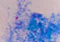 Cryptosporidium oocyte on blue