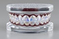 Crystal-Inspired Transparent Dental Model with Multicolored Reflections for Educational Use Generative AI Royalty Free Stock Photo