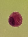 Crytpococcus neoformans encapsulated organism inside macrophage