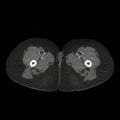 CT Axial plane