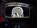 CT Brain angiography image on computer monitor