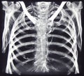 CT of chest bones Royalty Free Stock Photo
