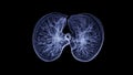 CT Chest or CT lung 3d rendering image with blue color showing Trachea and lung in respiratory system Royalty Free Stock Photo