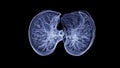 CT Chest or CT lung 3d rendering image with blue color showing Trachea and lung in respiratory system Royalty Free Stock Photo