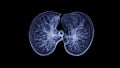CT Chest or CT lung 3d rendering image with blue color showing Trachea and lung in respiratory system Royalty Free Stock Photo