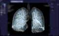 CT Chest or Lung 3D rendering image . Royalty Free Stock Photo