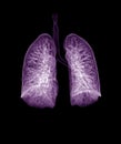 CT Chest or CT lung 3d rendering image Royalty Free Stock Photo