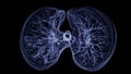 CT Chest or Lung 3d rendering image  showing Trachea and lung in respiratory system Royalty Free Stock Photo