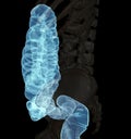 CT colonography or CT Scan of Colon 3D Rendering image lateral view.
