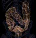 CT colonography 3D Rendering image.