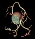 CT coronary angiography rendering