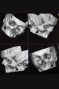 CT of head bones Royalty Free Stock Photo