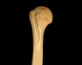 CT head of humerus 3D