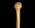 CT head of humerus 3D