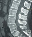 CT of Lumbar Spine Royalty Free Stock Photo