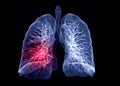 Selective focus of CT Chest or Lung 3D rendering image  on the screen. Royalty Free Stock Photo