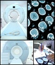 CT machine and the scan result.