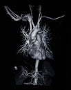 Ct scan angiogram (take photo from film x-ray) Royalty Free Stock Photo