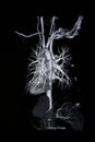 Ct scan angiogram (take photo from film x-ray) Royalty Free Stock Photo