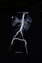 Ct scan angiogram (take photo from film x-ray) Royalty Free Stock Photo