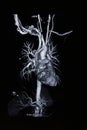 Ct scan angiogram (take photo from film x-ray)