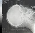 CT Scan Angles Royalty Free Stock Photo