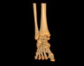 CT Scan ankle and foot