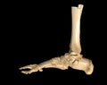 CT Scan ankle and foot
