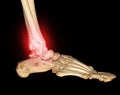 CT Scan ankle and foot