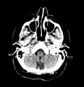 CT scan of brain, black and white vector graphic