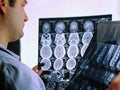 CT scan of the brain. MRI of the brain. Doctor, looking at the roentgenogram of a computer tomography on a negatoscope Royalty Free Stock Photo